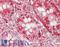 CFL1 antibody, LS-B13665, Lifespan Biosciences, Immunohistochemistry paraffin image 