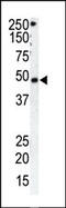 G Protein-Coupled Receptor Kinase 1 antibody, 62-581, ProSci, Western Blot image 