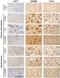 Chitinase 1 antibody, NBP1-84490, Novus Biologicals, Immunohistochemistry paraffin image 