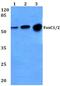 Forkhead Box C1 antibody, PA5-36261, Invitrogen Antibodies, Western Blot image 