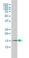 Peptidylprolyl Cis/Trans Isomerase, NIMA-Interacting 1 antibody, H00005300-M01, Novus Biologicals, Western Blot image 