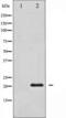 Baculoviral IAP Repeat Containing 5 antibody, TA325273, Origene, Western Blot image 