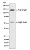 Kininogen 1 antibody, M02939-1, Boster Biological Technology, Western Blot image 