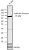 Prolactin Receptor antibody, 35-9200, Invitrogen Antibodies, Western Blot image 