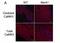 Calcium/Calmodulin Dependent Protein Kinase II Alpha antibody, GTX36254, GeneTex, Immunohistochemistry paraffin image 