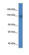 Cell Migration Inducing Hyaluronidase 2 antibody, orb325001, Biorbyt, Western Blot image 