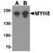 Myosin Heavy Chain 8 antibody, TA349135, Origene, Western Blot image 