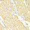 Ribonucleotide Reductase Regulatory Subunit M2 antibody, LS-C333948, Lifespan Biosciences, Immunohistochemistry frozen image 