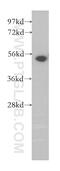 Ribosomal Oxygenase 2 antibody, 12214-1-AP, Proteintech Group, Western Blot image 