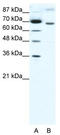 Rac GTPase Activating Protein 1 antibody, TA329685, Origene, Western Blot image 