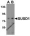 Sushi Domain Containing 1 antibody, 8609, ProSci, Western Blot image 