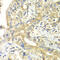 Translocase Of Inner Mitochondrial Membrane 17A antibody, 15-082, ProSci, Immunohistochemistry frozen image 