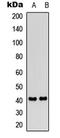 Prostacyclin receptor antibody, LS-C368482, Lifespan Biosciences, Western Blot image 