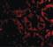 STEAP2 Metalloreductase antibody, LS-B1405, Lifespan Biosciences, Immunofluorescence image 