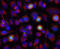 Aurora Kinase A antibody, LS-C204509, Lifespan Biosciences, Immunocytochemistry image 