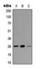 Troponin I3, Cardiac Type antibody, orb393177, Biorbyt, Western Blot image 