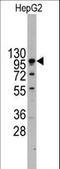 Cadherin 4 antibody, LS-B8990, Lifespan Biosciences, Western Blot image 