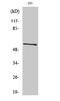 Carbonic Anhydrase 9 antibody, STJ91940, St John