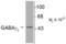 Gamma-Aminobutyric Acid Type A Receptor Gamma2 Subunit antibody, TA309139, Origene, Western Blot image 