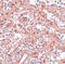 Lin-28 Homolog A antibody, 5605, ProSci, Immunohistochemistry paraffin image 