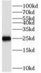 High Mobility Group Box 1 antibody, FNab10218, FineTest, Western Blot image 