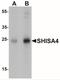 Shisa Family Member 4 antibody, NBP2-22341, Novus Biologicals, Western Blot image 