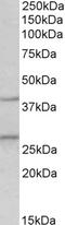 Chymase 1 antibody, 42-759, ProSci, Immunohistochemistry paraffin image 