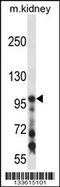 Collagen Type I Alpha 1 Chain antibody, MBS9202150, MyBioSource, Western Blot image 