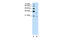 Deoxyribonuclease-2-beta antibody, 29-779, ProSci, Western Blot image 