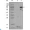 Peroxisome Proliferator Activated Receptor Gamma antibody, LS-C814069, Lifespan Biosciences, Western Blot image 