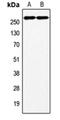 Coagulation Factor VIII antibody, orb213914, Biorbyt, Western Blot image 