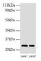 Transgelin antibody, CSB-PA00804A0Rb, Cusabio, Western Blot image 