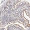 Myomesin 3 antibody, HPA028132, Atlas Antibodies, Immunohistochemistry frozen image 