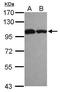 Activating Signal Cointegrator 1 Complex Subunit 2 antibody, PA5-30849, Invitrogen Antibodies, Western Blot image 