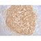 Complement C3d Receptor 2 antibody, LS-C387355, Lifespan Biosciences, Immunohistochemistry paraffin image 