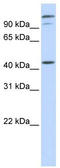 AFG3 Like Matrix AAA Peptidase Subunit 2 antibody, TA341861, Origene, Western Blot image 