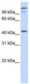 AFG3-like protein 2 antibody, TA341861, Origene, Western Blot image 