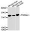 Triggering Receptor Expressed On Myeloid Cells Like 1 antibody, A10414, ABclonal Technology, Western Blot image 