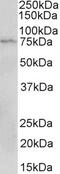 MAPK Activated Protein Kinase 2 antibody, 43-314, ProSci, Enzyme Linked Immunosorbent Assay image 