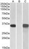 Cysteine Rich Secretory Protein 2 antibody, NBP1-52012, Novus Biologicals, Western Blot image 