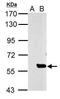 SLU7 Homolog, Splicing Factor antibody, PA5-32225, Invitrogen Antibodies, Western Blot image 