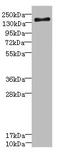 Sodium Voltage-Gated Channel Alpha Subunit 7 antibody, LS-C676458, Lifespan Biosciences, Western Blot image 