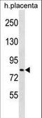 HECT Domain E3 Ubiquitin Protein Ligase 2 antibody, LS-C159818, Lifespan Biosciences, Western Blot image 