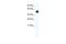 MPN Domain Containing antibody, A14225, Boster Biological Technology, Western Blot image 