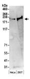 Claspin antibody, GTX23719, GeneTex, Western Blot image 