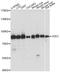 G2/M-Phase Specific E3 Ubiquitin Protein Ligase antibody, A14410, ABclonal Technology, Western Blot image 