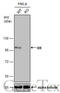 Insulin Degrading Enzyme antibody, GTX633625, GeneTex, Western Blot image 