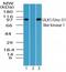 Unc-51 Like Autophagy Activating Kinase 1 antibody, NBP2-24738, Novus Biologicals, Western Blot image 