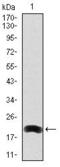 Low-density lipoprotein receptor-related protein 5 antibody, GTX60567, GeneTex, Western Blot image 