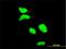 Apoptosis Antagonizing Transcription Factor antibody, H00026574-M09, Novus Biologicals, Immunofluorescence image 